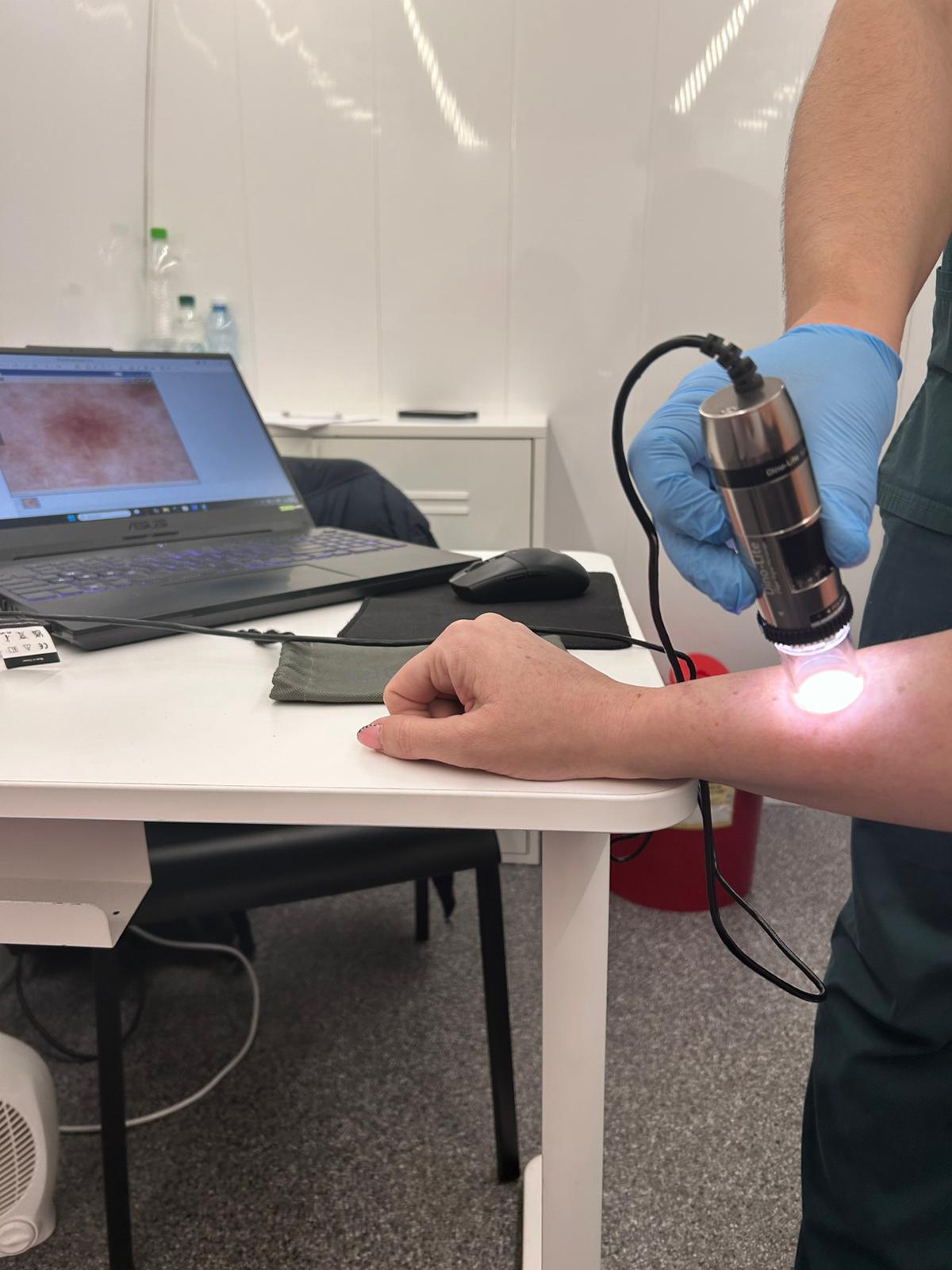 Ruszyły bezpłatne badania dermatoskopowe w Powiecie Polickim